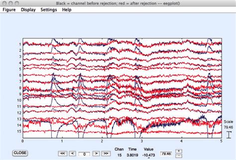 5 Basics Of Eeg 101 Data Collection Processing Analysis Imotions 5 Basics Of Eeg 101 Data Collection Processing Analysis Imotions