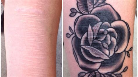 A Tattoo Artist S 10 Years Of Turning Scars Into Art Npr