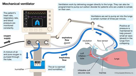 Basics In Mechanical Ventilation Getting To Know Its Parameters And Set Up Description From