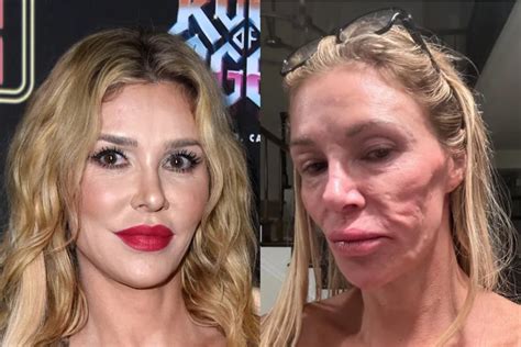 Brandi Glanville S Transformation After Two Year Face Parasite Battle Brandi Glanville S Transformation After Two Year Face Parasite Battle