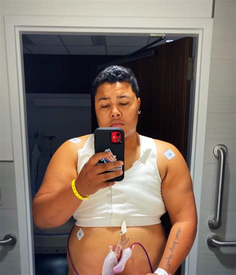 Comprehensive Guide Scar Care After Top Surgery Motivo Scar Care Comprehensive Guide Scar Care After Top Surgery Motivo Scar Care