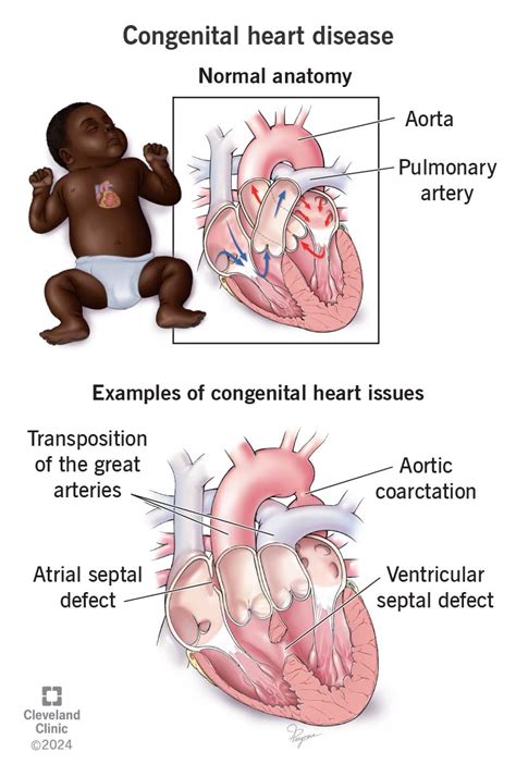 Congenital Heart Disease In Williams Syndrome Download Scientific Diagram