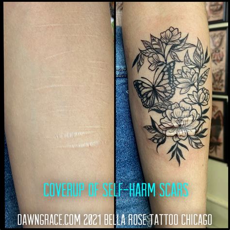 Cover Up Tattoo Scars Before After Photos Arm Scars