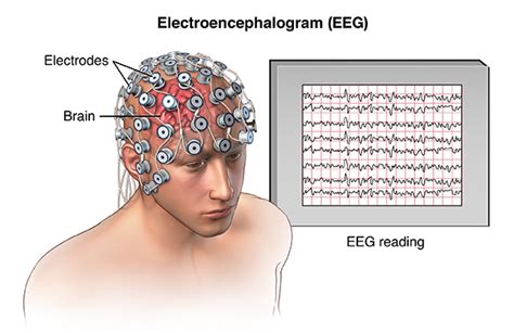 Electroencephalogram Eeg Johns Hopkins Medicine Electroencephalogram Eeg Johns Hopkins Medicine