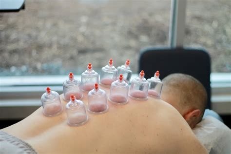 Find Out How To Ease Muscle Discomfort With Gliding Cupping Lorraine S Treatment Room Find Out How To Ease Muscle Discomfort With Gliding Cupping Lorraine S Treatment Room