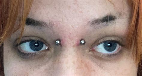 Got A Bridge Freshly Pierced But It Pulls My Eyelids Is That Normal In The First Days R Piercing Got A Bridge Freshly Pierced But It Pulls My Eyelids Is That Normal In The First Days R Piercing