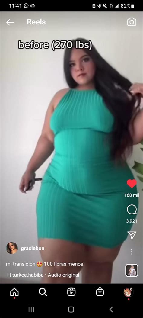 How Did Model Graciebon Get Rid Of Her Doublechin Facial Fat I M Interested In That Procedure R Qovesstudio