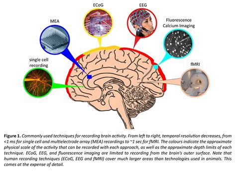 How To Measure Brain Activity In People Queensland Brain Institute University Of Queensland How To Measure Brain Activity In People Queensland Brain Institute University Of Queensland