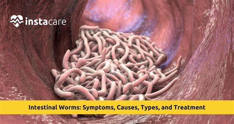Intestinal Worms In Humans Causes Symptoms Deworming Treatment Intestinal Worms In Humans Causes Symptoms Deworming Treatment