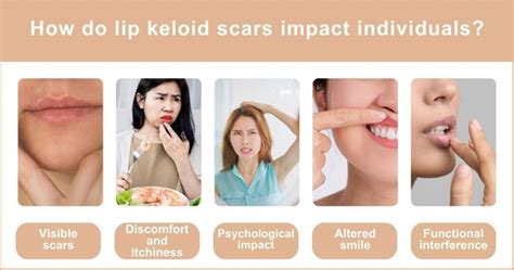 Keloid Scar Lip Treatment Options Regain Your Smile