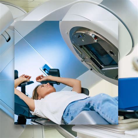 Lung Cancer Radiation Treatment