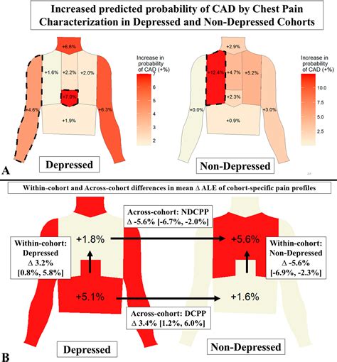Machine Learning Reveals How Depression Influences Chest Pain Localisation And Its Predictive Value For Coronary Artery Disease Sciencedirect