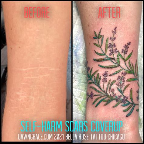 Melville Artist Offers Free Tattoos To Cover Scars From Self Harm Cbc News