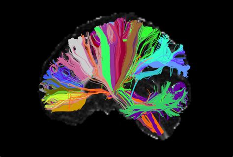 Mental Illness Is Not In Your Head Boston Review Mental Illness Is Not In Your Head Boston Review