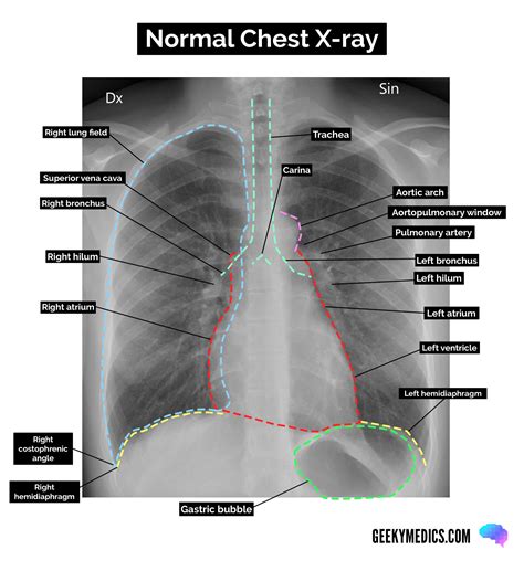 Normal X Ray Normal X Ray