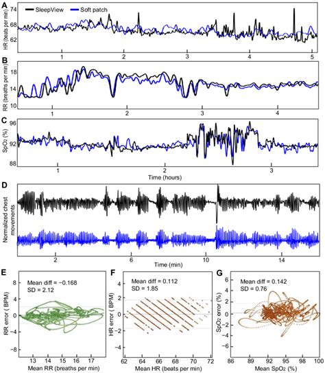 Overnight Sleep Study With Patients And Healthy Control Subjects A Download Scientific Diagram