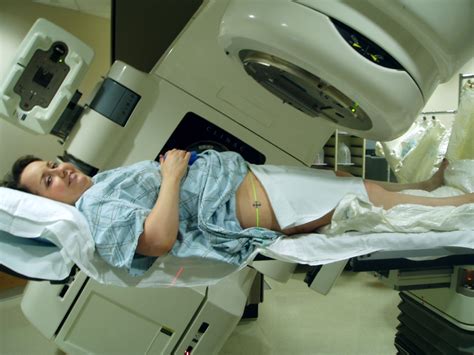 Radiation Therapy Wikipedia