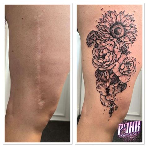 Scar Cover Up I Absolutely Love Tattooing Over Scars Although The Actual Tattoo Process Is A Bit More Difficult The Result Is So Rewarding Tattoos Have The Power To Help People Feel