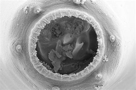 Stress Turns Tiny Worm Into A Big Mouthed Cannibal Science Aaas