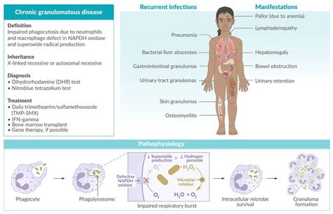 Symptoms And Sequelae Of Chronic Granulomatous Disease For Hcps