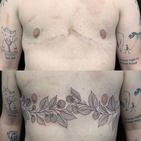 Tattoo Top Surgery Guide