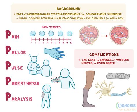 The 5 P S Circulation Assessment Acronym Osmosis