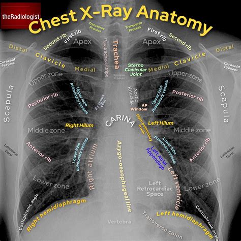 Understanding The Anatomy Of A Normal Chest X Ray Understanding The Anatomy Of A Normal Chest X Ray