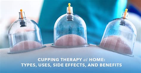 What Is Cupping Therapy Uses Benefits Side Effects And More What Is Cupping Therapy Uses Benefits Side Effects And More