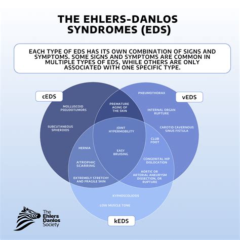 What Is Eds The Ehlers Danlos Society What Is Eds The Ehlers Danlos Society
