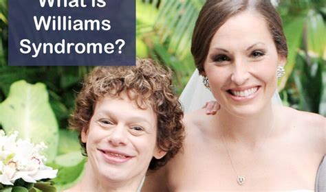 Williams Syndrome Symptoms Diagnosis And Treatments