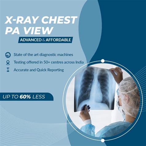 X Ray Chest Pa View Aarthi Scans And Labs X Ray Chest Pa View Aarthi Scans And Labs